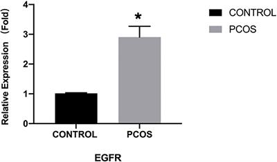 Role of EGFR expressed on the granulosa cells in the pathogenesis of polycystic ovarian syndrome